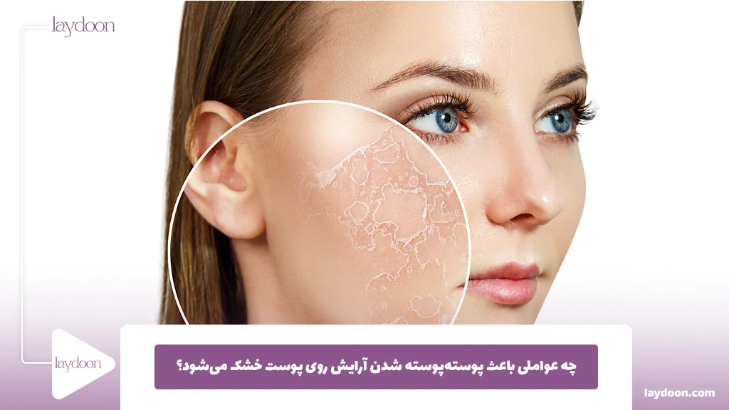 چه عواملی باعث پوسته‌پوسته شدن آرایش روی پوست خشک می‌شود؟